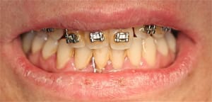 Img 6837 axhayd - Eugenol