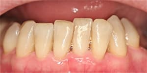 Img 6913 slkxrj - Eugenol