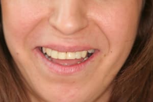 Img 6926 oo8urk - Eugenol