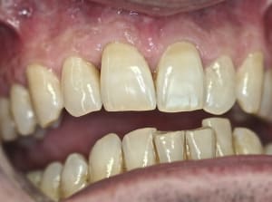 Img 7415 q2n5rz - Eugenol