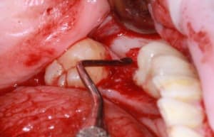 Img 7555r sbexhm - Eugenol