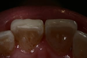 Img 7608 wbfqlp - Eugenol