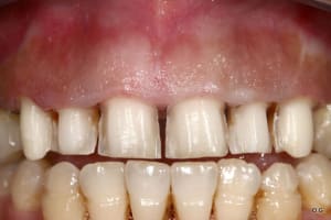 Img 7733 cnwano - Eugenol