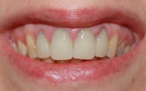 Img 7899 oublym - Eugenol