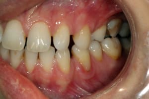 Img 7899 tbhhj4 - Eugenol