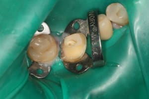 Img 8334 s01j6o - Eugenol