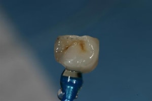 Img 8466  large  sq4xvt - Eugenol