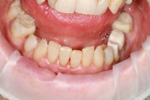 Img 8762 nein6l - Eugenol