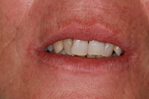 Img 8763 mcg1xi - Eugenol