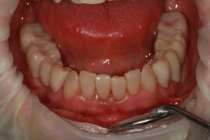 Img 8766 dtvkmm - Eugenol