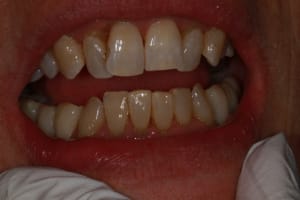 Img 8767 c7j9hj - Eugenol