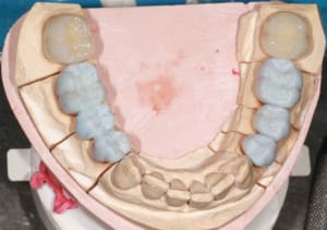 Img 8787 uxnsl5 - Eugenol