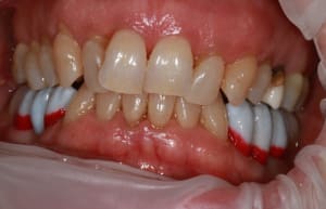 Img 8794 q14fqd - Eugenol