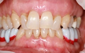 Img 8796 budmt0 - Eugenol