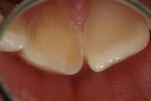 Img 8860 kejfp5 - Eugenol