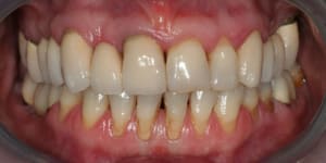 Img 8880 ix6jr8 - Eugenol