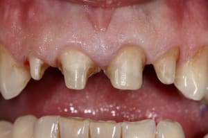 Img 9161 nwisp4 - Eugenol