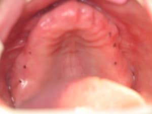 Img 9233 hd3zv2 - Eugenol