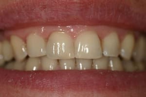 Img 95592 niwbqj - Eugenol