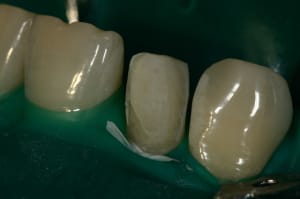 Img 9591 bacxnw - Eugenol