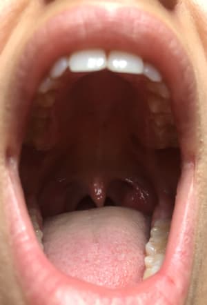 Img 9648 hrlku5 - Eugenol