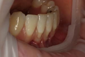 Img 9920 lxqifx - Eugenol