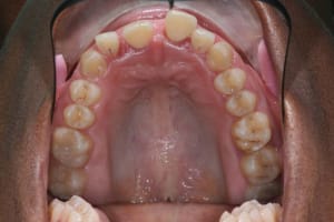 Img duf.m - Eugenol