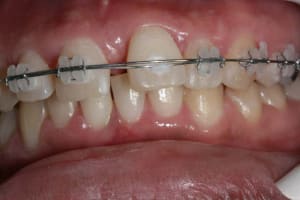 Img duf.m - Eugenol