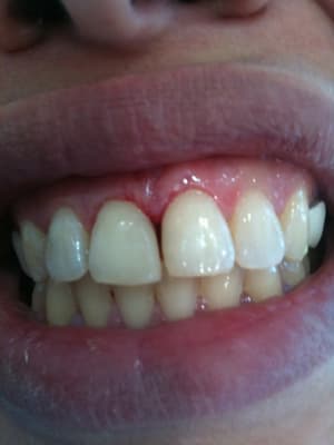 Iphone 071 iwe99h - Eugenol
