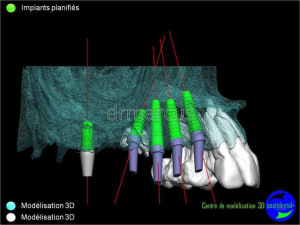 Image10 hsrox6 - Eugenol