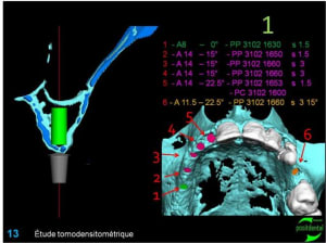 Image13 fb0hcu - Eugenol