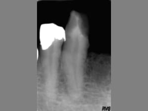 Image1 cauygs - Eugenol