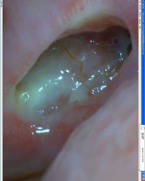 Image1 knodvg - Eugenol