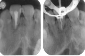 Image1 npndyw - Eugenol