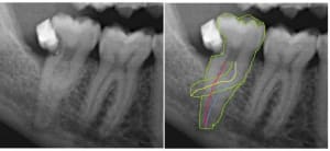 Image1 sfycwl - Eugenol