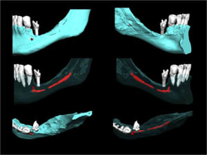 Image2 pornt8 - Eugenol