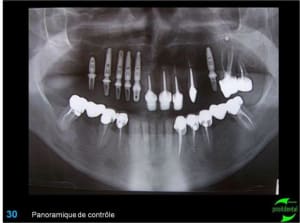 Image30 aavmsl - Eugenol