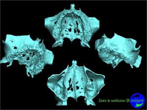 Image3 iwdsou - Eugenol
