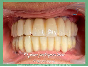 Image3 ks6xd8 - Eugenol