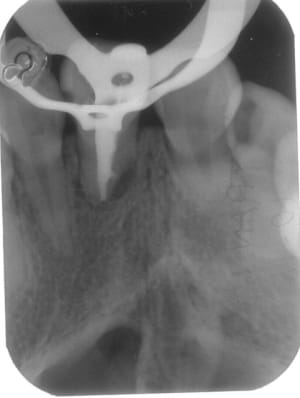 Image3 xwhtzw - Eugenol