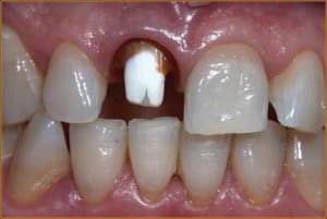Image5 agcdsj - Eugenol
