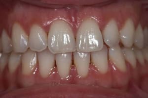 Image5 joj2md - Eugenol