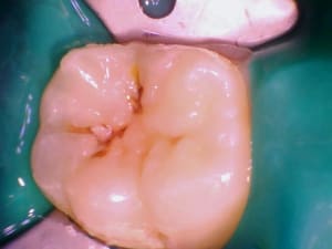Image 001 kjcpvd - Eugenol