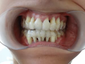 Image 36 imili6 - Eugenol