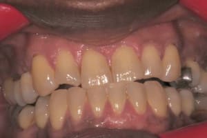 Img 1 fkctcu - Eugenol