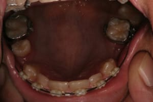 Img 2784 elnmmd - Eugenol