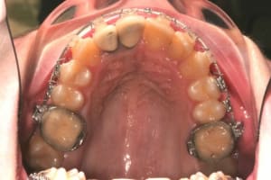 Img 4584 ywthil - Eugenol