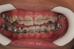 Img 5286 l7ywcr - Eugenol