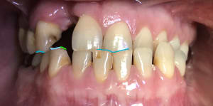 Inked7f6cbbb1 a54f 4995 b0d9 c69e9b952dd4 q6ipda li s3jwxp - Eugenol