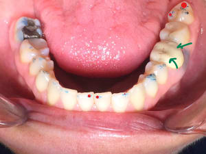 Inkedinkedimg 0269 abq6zw li ujqmm3 - Eugenol